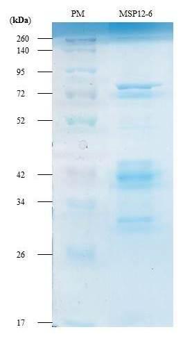 bloqueio com o leite, durante a incubação com anticorpo secundário ou mesmo durante a revelação. Figura 7. Gel corado com Coomasie brilliant blue.