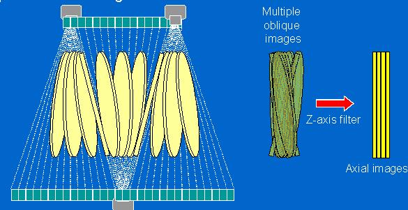 Efeitos do cone-beam Reconstrução de imagens a partir de planos otimizados (ASSR techniques)