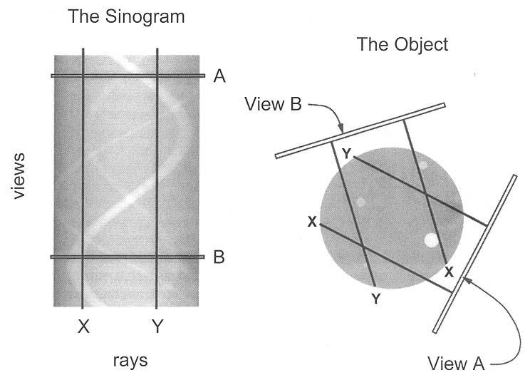 Sinograma Serviço de Informática InCor HC FMUSP - Aula Processamento de Imagens Armazena os dados antes da reconstrução Objetos nos limites do FOV geram uma senóide no