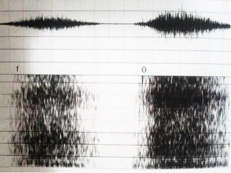 24 A mudança da forma do trato vocal durante o ato de fala é marcada acusticamente pela mudança de ressonância do trato vocal.