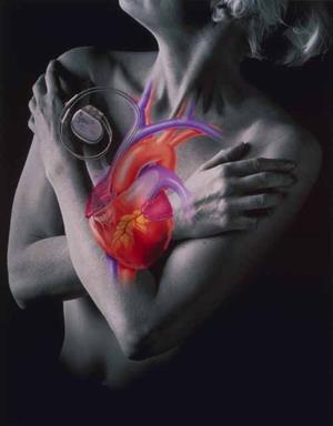 DROGAS VASODILATADORAS São agentes úteis no controle da cardiopatia isquêmica aguda, HAS,