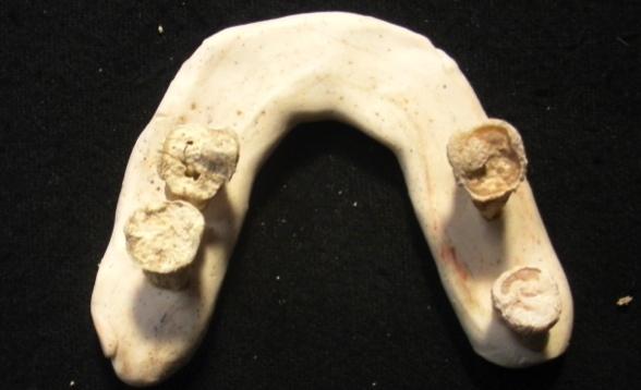 Tendo em conta a falta de preservação da dentição superior, apenas os dentes soltos inferiores foram estudados.