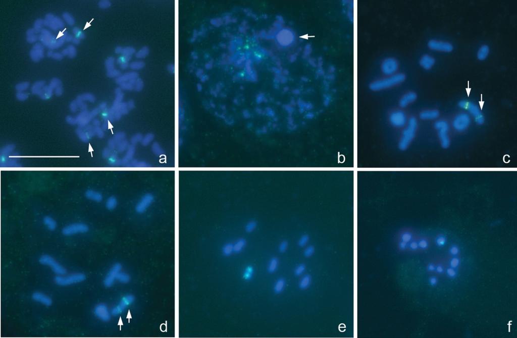 is, spermatozoa are of two kinds: one with