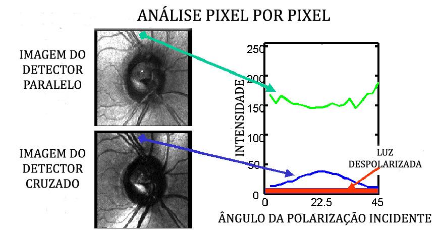 MÉTODOS 51 A Imagem Confocal calculada na análise é similar às imagens obtidas com o oftalmoscópio confocal de varredura que utiliza o LASER infravermelho 9, 98.