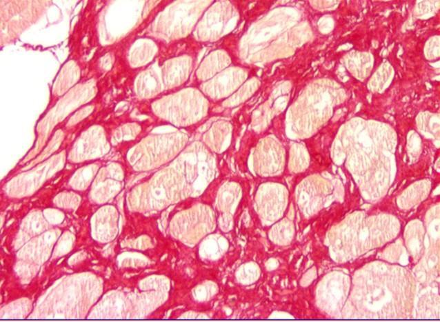 3 Material e Métodos 36 processamento histológico convencional. Em cortes histológicos, foi realizada a análise quantitativa do colágeno no interstício do cardiomiócito.