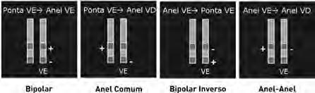 O PainFREE Rx II Trial comprovou a eficácia de ATP (estimulação antitaquicardia) para taquicardias rápidas (até 250 bpm), sem precisar de um choque e sem prejudicar a segurança do paciente.