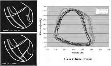 do gerador. Figura 7 - Ciclos volume-pressão com duas diferentes polaridades de estimulação.