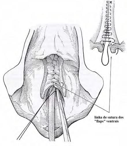 Imagem 23. Aposição dos flaps ventrais 29. É formado o tecto da nova uretra. Imagem 24. Aposição dos flaps dorsais 29.