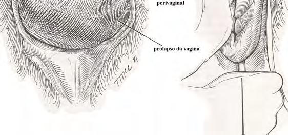 Particularmente se a vaca for estabulada num plano inclinado, que permita manter o terço posterior mais elevado 3, 18. Para manter a vagina na posição normal são realizadas suturas de retenção.