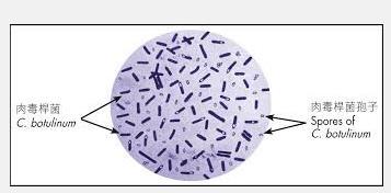 Bacilos Gram-negativos fermentadores o Infecções