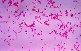 o Fusobacterium sp. o Actinobacillus sp.
