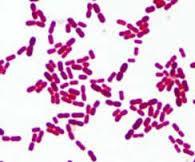 o Doenças sistêmicas de potros e leitões. o Haemophilus sp.