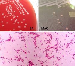 o Bovinos: septicemia, bronquite, meningocefalite. o Ovinos: epidermite vulvite e mastite.