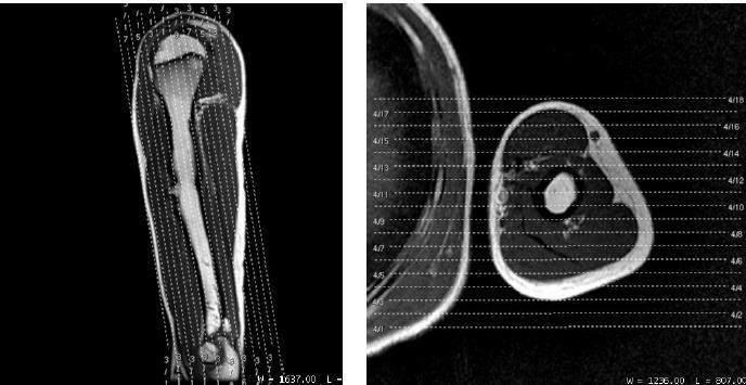 - Coronal: 7 / 77 Programar a sequência angulada