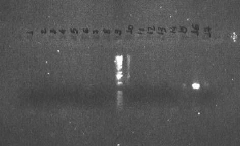 864 pb Figura 16 Análise por eletroforese em gel de agarose 1% da PCR de plantas regeneradas de embriões de B. brizantha cv. Marandu bombardeados com o plasmídeo pact1-d.