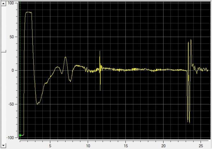 (a) Inclusões espessa de aproximadamente 200µm orientada na direção do fluxo de material e ecograma do ensaio de ultrassom apresentando um pico bem definido (eixo das