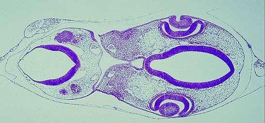 c. Identificar a face ventral e a face dorsal do embrião. Início do mielencéfalo (presença da superfície das vesículas auditivas), diencéfalo, cálice óptico e vesícula do cristalino (RA).