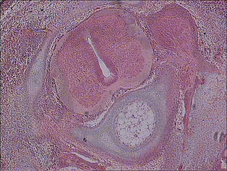 4. Corte transversal (Embrião de galinha com 6 dias de incubação) Identificar: 1. Esboço da vértebra 2.