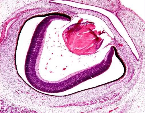 Corte sagital do feto humano com 8 semanas Identificar: 1. Retina Neural (camada Marginal, Manto e Ependimária) 2. Retina Pigmentada 3. Cristalino 4. Córnea 5.