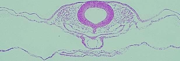 Identificar ainda, o intestino primitivo anterior (RA), as aortas dorsais, as aortas ventrais, a