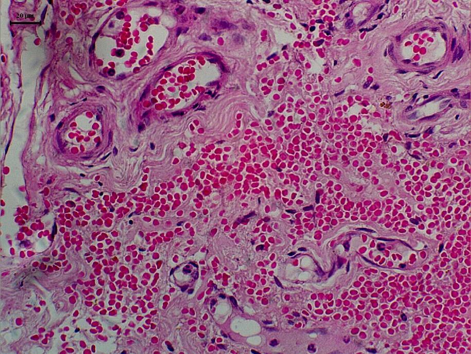 ovariossalpingohisterectomia. Ovário Fibrose Tecido de Células inflamatórias Granulação Direito 0.64 a 1.00 a 0.36 a Esquerdo 0.82 a 1.27 a 0.