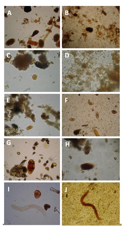 RESULTADOS Figura 1 Fotomicrografias obtidas através de microscópio ótico a partir da visualização de sedimentos de amostras analisadas aos pares pela Sedimentação Espontânea em Tubo (SE), Paratest