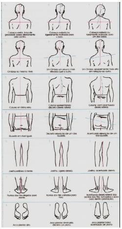 Método de avaliação postural da