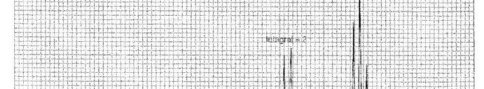 Quatr arranjs pssíveis ααα ( C3 = 3/) ααβ ( C3 = ½), u αβα ( C3 = ½), u βαα ( C3 = ½) Três pssibilidades!! αββ ( C3 = -½), u ββα ( C3 = -½), u βαβ ( C3 = -½) Três pssibilidades!