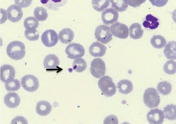 66 FIGURA 1. FOTOMICROGRAFIA DE ESFREGAÇO DE SANGUE PERIFÉRICO DE CÃO (CÃO 22) NATURALMENTE INFECTADO POR R. vitalii DEMONSTRANDO PRESENÇA DE PIROPLASMAS DE VIDA LIVRE E INTRA-ERITROCITÁRIO (SETA).