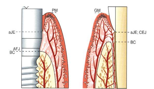 FARIAS, OLIVEIRA e GOMES, 2016. Imagem 1 - Vascularização do tecido periimplantar e periodontal. FONTE: PALACCI E INGVAR, 2000.