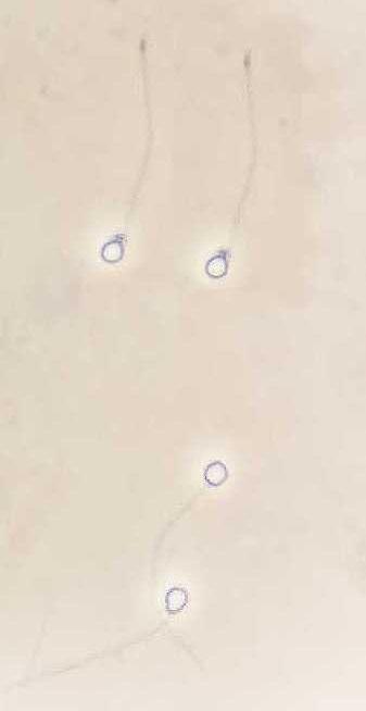(p>0,05) O espermatozóide de piau-açu apresenta cabeça de forma ovóide, característica morfológica bastante primitiva, de acordo com