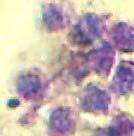 Essas células possuíam núcleo basófilo e de contorno regular. O citoplasma mostrou-se escasso e de difícil visualização.