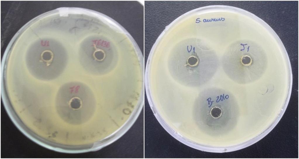 30 Figura 4 Halos de inibição das culturas de E. coli (A) e S. aureus (B) em meio ágar Müller- Hinton, pela ação bacteriostática das amostras do mel uruçu fresco e armazenado.