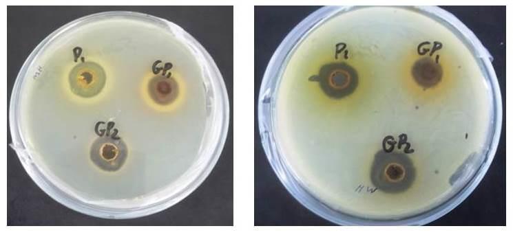 35 Figura 6 - Atividade antimicrobiana do extrato hidroetanólico de geoprópolis (GP 1 e GP 2 ) e própolis verde (P 1 - controle) frente às cepas MRSA1 (A) e MRSA2 (B). A B Fonte: Valberta A.