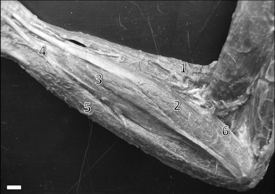 18 Grupo extensor Semelhante GIAC=0.12 5 Semelhante G6 3 Semelhante GIAC=0.13 4 Figura 1. Fotografia anterior do antebraço direito de um C. libidinosus.