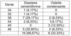 CARVALHO Tabela 1 Relação entre etnia e gênero. Tabela 2 Incidência de displasia cementiforme.