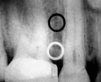 47 figura 25a figura 25b figura 26 Em contraparte, a radiografia periapical fornece