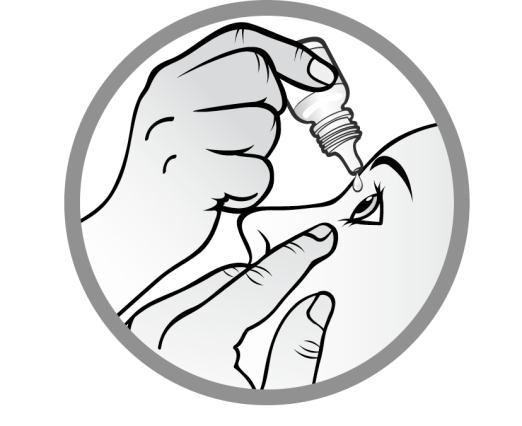 2 - Inverta o frasco, pressionando-o levemente com o dedo polegar ou indicador, como demonstrado na figura a seguir, até que uma única gota seja dispensada no olho, como orientado pelo seu médico.