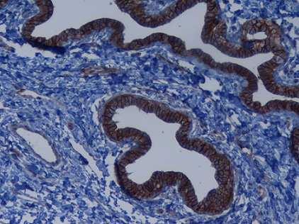 Imunoexpressão das Claudinas nas amostras de tecido mamário felino Imunoexpressão da CLDN-1 No tecido glandular mamário felino normal, a CLDN-1 foi sistematicamente expressa apenas nas células