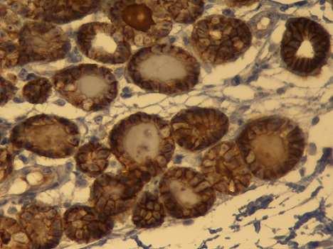 Imunoexpressão da CLDN-7 Nas amostras de tecido mamário felino normal, observou-se marcação apenas nas células epiteliais luminais, sendo que o número de células marcadas variou em 81-100%.