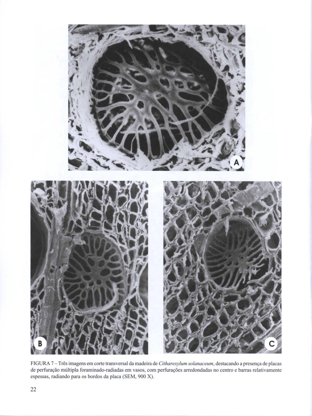 FIGURA 7 - Três imagens em corte transversal da madeira de Citharexylum solanaceum, destacando a presença de placas de perfuração múltipla