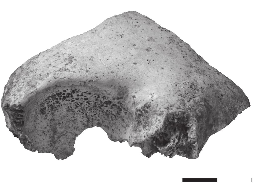 FIG. 50 Cribra orbitalia na órbita direita 233.2340.37. festa-se nos ossos mais finos do esqueleto (crânio, costelas e.g.