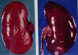 Hiperemia Passiva Morfologia Características Macroscópicas