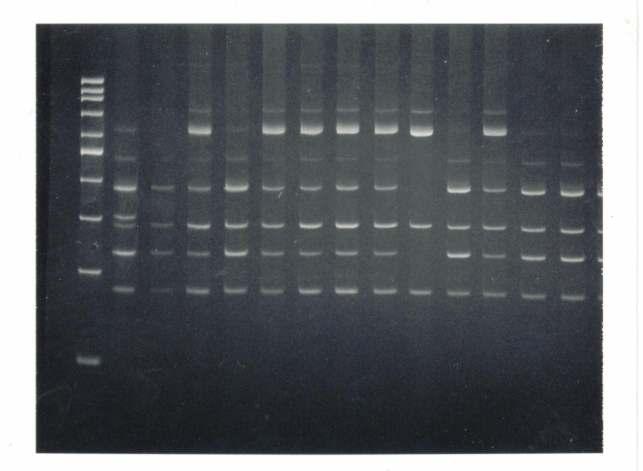 615 pb 491 pb Figura 2. Gel de agarose convencional 2% para checagem de amplificação por PCR Multiplex do gene XRCC1, onde M= marcador de peso molecular (200 pb).