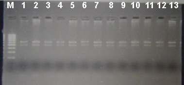 PCR-RFLP para detecção do polimorfismo XRCC1-MspI, onde M= marcador de peso molecular (100 pb).