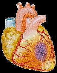 Dificuldade respiratória. Palidez. Sudorese.