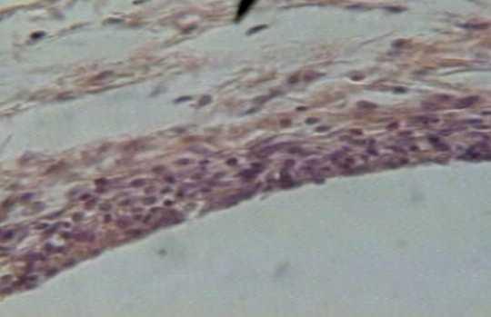 Figura 1- Aspecto da camada fibrosa ao redor do material, presença numerosos vasos sanguíneos e infiltrado inflamatório morado. H.E.