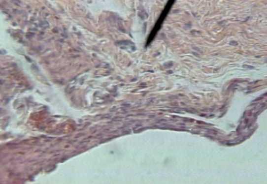 Objetiva 40X, período quinze dias. Figura 2 Aspecto talhado da cápsula evinciando numerosos fibroblastos jovens. H.E.