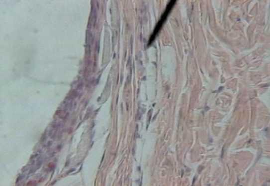 Aos trinta e sessenta dias a cápsula envolvente apresentava-se mais fibrosa com poucos fibroblastos forma fusiforme, escassas células