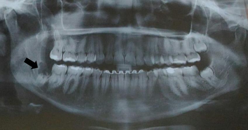 cirurgia.